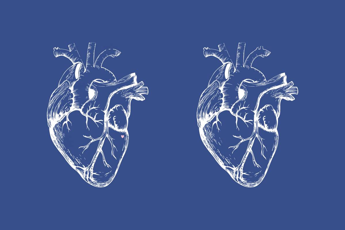 ¿Dónde están las diferencias entre los dos corazones?