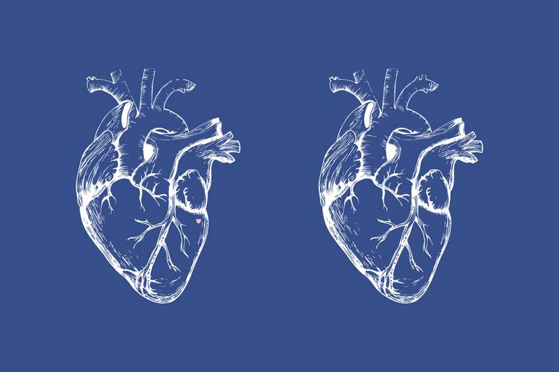 ¿Dónde están las diferencias entre los dos corazones?