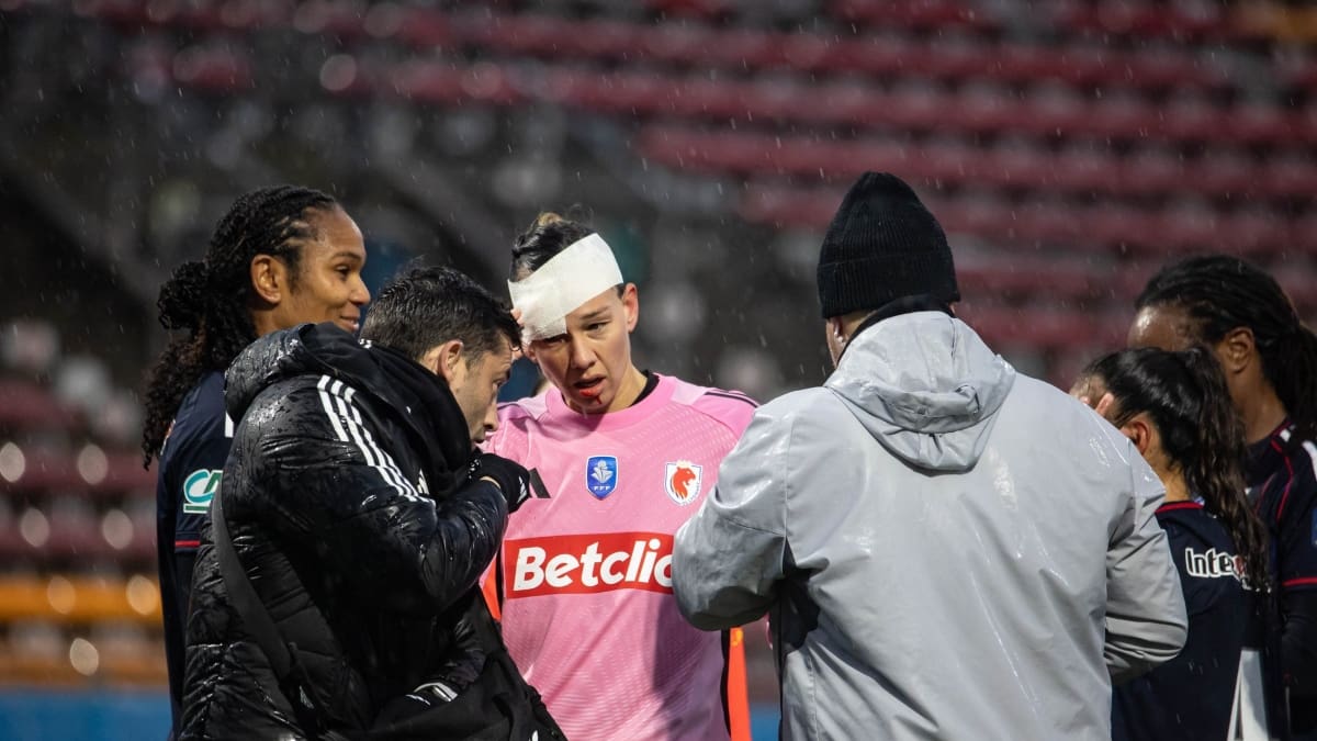 Tiane Endler sufrió duro golpe en Francia y tuvieron que ponerle puntos: así le quedó el rostro