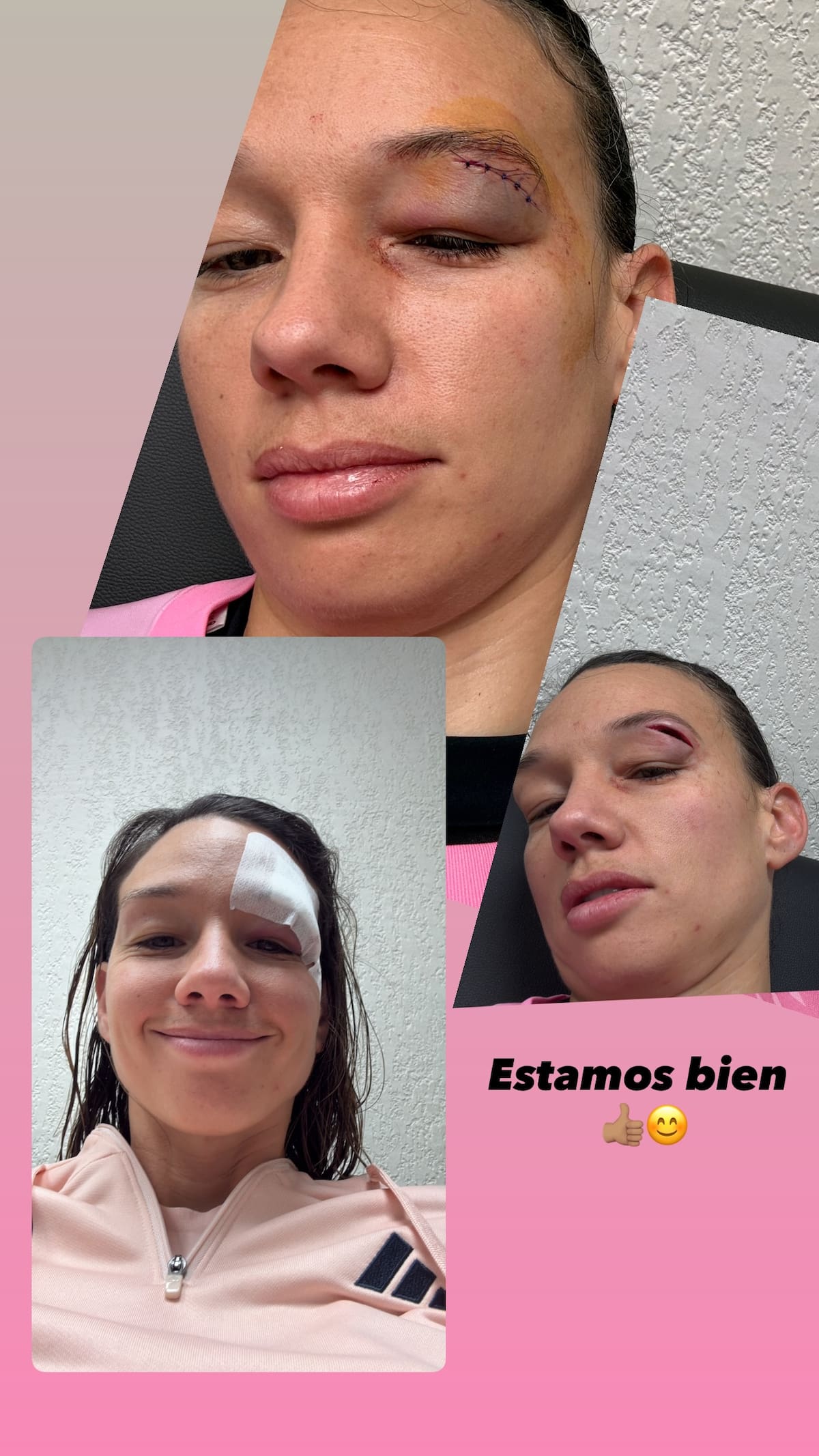 La arquera chilena mostró cómo le quedó el ojo tras el choque en Francia