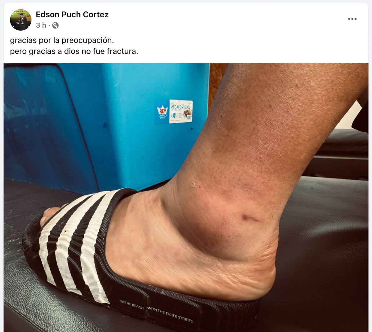 Así había quedado tras la falta contra La Calera.