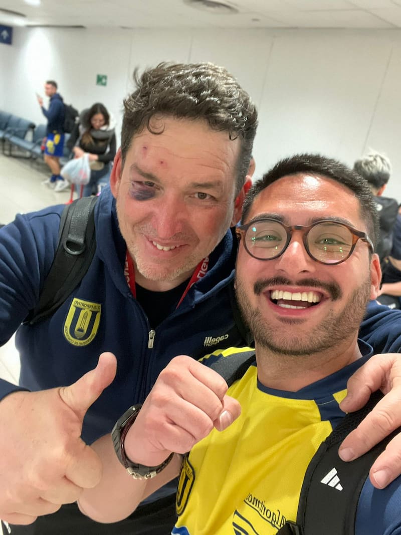 Así terminó Ernesto Llorca, funcionario del Campanil agredido.