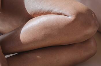 Estos prácticos hábitos te ayudarán a disminuir las várices