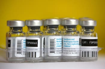 ¿Cuáles son las medidas que tomará Chile ante un eventual brote de la Viruela del Mono?